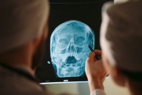 X-ray of skull / 
radiografía del cráneo